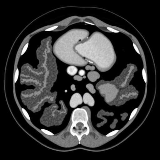 Dual-Time-Point PET/CT Enhances Colorectal Cancer Diagnosis – BioTechGrid