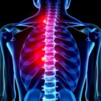 radiotherapy-eases-acute-malignant-spinal-compression