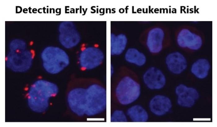 how-aging-gut-bacteria-may-increase-leukemia-risk-and-beyond