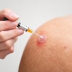 herpes-zoster-vaccination-linked-to-reduced-dementia-risk:-new-insights