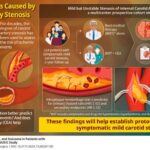 reevaluating-stroke-risk-in-patients-with-atherosclerotic-carotid-stenosis