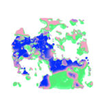 unraveling-tumors-in-three-dimensions