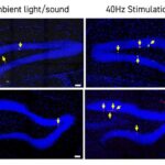 40hz-light-and-sound-enhance-cognition,-neurogenesis,-and-connectivity-in-down-syndrome-mice