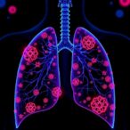pan-cancer-chrdl1-study-highlights-lung-cancer-role