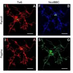 lncrna-rmst-axis-controls-autophagy-in-tnbc