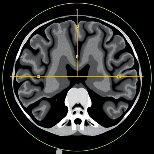 cnn-automates-ct-scoring-for-sinus-imaging