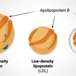 breakthrough-simple-test-enhances-prediction-of-heart-disease-risk