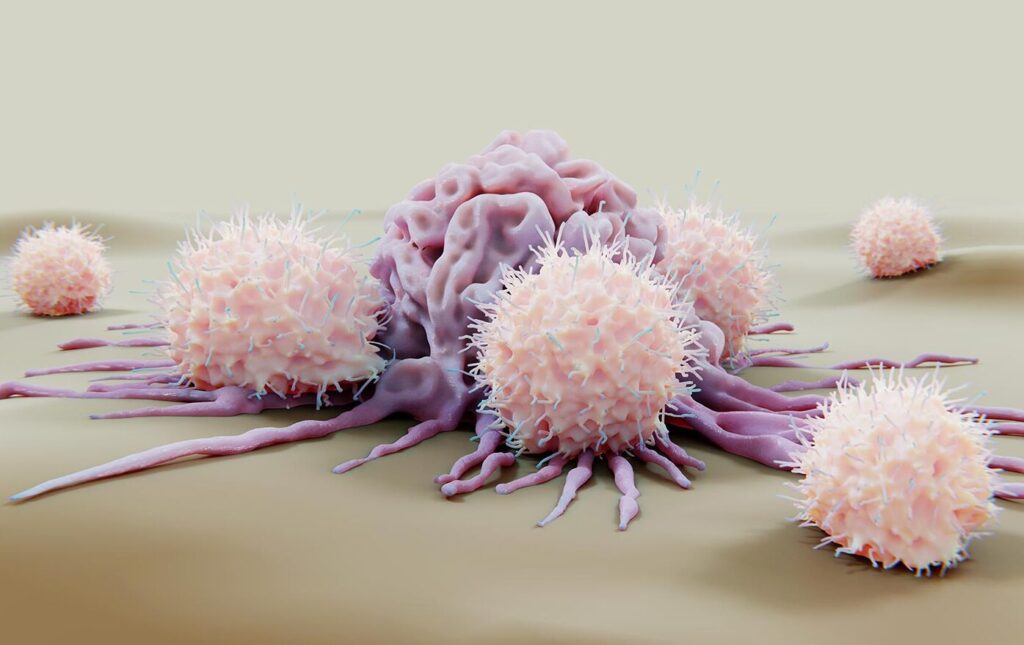 aacr-2025:-logic-gated-car-nk-therapy-drives-remission-in-relapsed,-refractory-aml