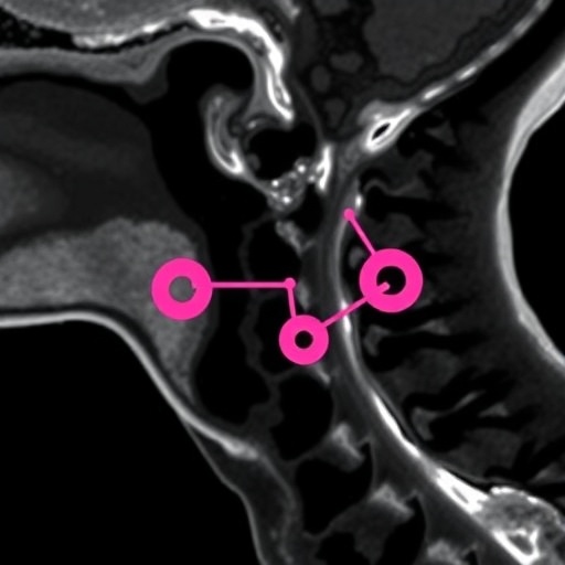 epcam-links-cervical-lymph-node-metastasis