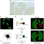 immune-defense-roles-of-toxoplasma-gondii’s-latent-stage