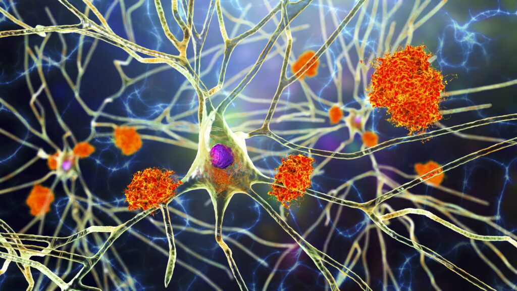 increase-of-clusterin-protein-could-protect-from-alzheimer’s-disease