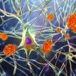 increase-of-clusterin-protein-could-protect-from-alzheimer’s-disease
