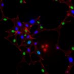 il-17a+-nkp44−-ilc3-cells-build-in-fap-duodenum
