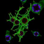 t-bet+-cd8+-t-cells-drive-anti-pd-1-response
