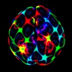 chemical-imaging-reveals-aβ-plaque-diversity-in-alzheimer’s