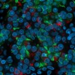 innovative-stem-cell-model-reveals-dysfunctional-alpha-cells-regulating-blood-sugar-in-diabetes