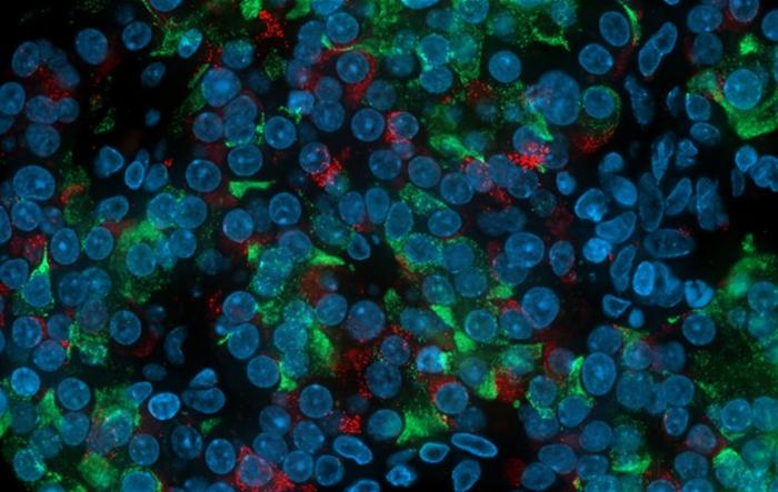 innovative-stem-cell-model-reveals-dysfunctional-alpha-cells-regulating-blood-sugar-in-diabetes
