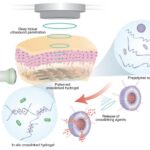 in-vivo-3d-printing-powered-by-sound-waves