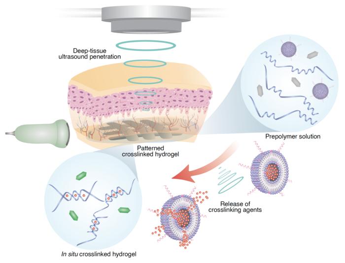 in-vivo-3d-printing-powered-by-sound-waves