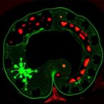 egfr/mapk,-not-pi3k,-drive-colorectal-therapy-resistance