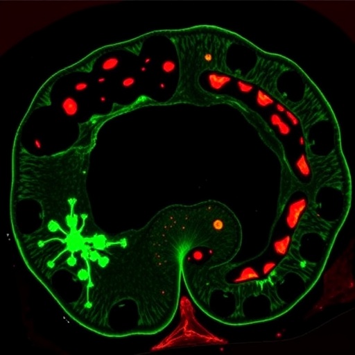 egfr/mapk,-not-pi3k,-drive-colorectal-therapy-resistance