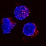 lipid-rich-fluid-drives-immune-dysfunction-in-ovarian-cancer