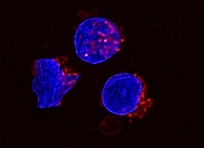 lipid-rich-fluid-drives-immune-dysfunction-in-ovarian-cancer