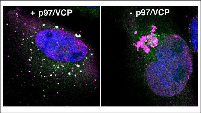 enzyme-identified-as-crucial-player-in-protein-quality-control