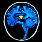 minimally-invasive-stroke-model-for-awake-mice