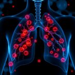 let-7-blocks-fibrotic-cells-in-lung-repair