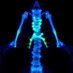 detecting-radiation-esophagitis-using-18f-fapi-04-pet