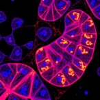 molecular-profiling-reveals-fh-deficient-renal-cancer-targets