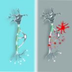 car-t-cell-therapy-related-“brain-fog”-mechanism-and-treatment-approaches-identified