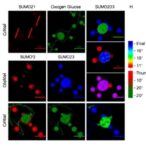sumo2/3-regulates-cell-survival-under-oxygen-glucose-stress