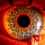 mir-125a-5p-in-evs-eases-diabetic-retinopathy