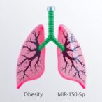 obesity-linked-mir-150-5p-drop-worsens-lung-injury