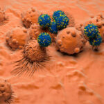 car-t-cell-therapy:-new-advances-move-on-past-setbacks