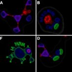 prednisone-modulates-t-effector-memory-cells-in-advanced-thymoma