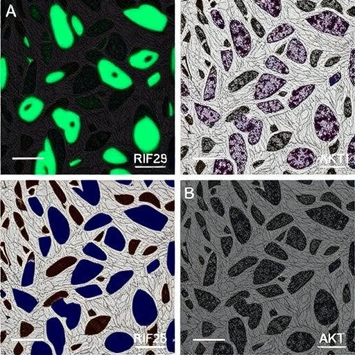 trf-29-79mp9p9nh525-suppresses-gastric-cancer-via-kif14/akt