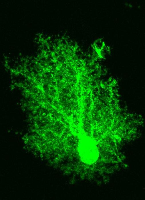 unsung-cell-type-drives-brain-rewiring-breakthrough