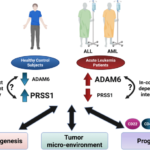 adam6-and-prss1:-new-leukemia-biomarkers