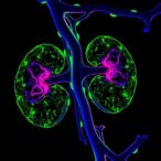 matrix-metalloproteinase-10-drives-kidney-fibrosis-via-β-catenin