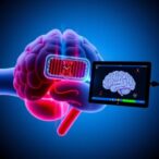 multi-locus-tms-system-advances-clinical-brain-therapy