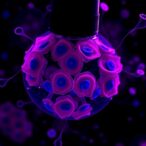 single-cell-insights-reveal-microscopic-colitis-details