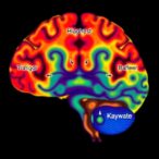 mapping-glioblastoma-metabolism-via-13c-glucose-imaging