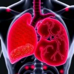 genetic-lipid-model-predicts-hcc-therapy-outcomes