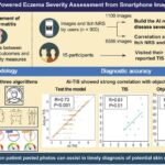 smartphone-based-ai-tool-revolutionizes-eczema-severity-assessment-in-real-world-conditions