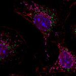 new-jax-study-reveals-why-patients-with-mitochondrial-disease-are-more-vulnerable-to-infections