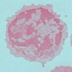 study-reveals-aging-impairs-metabolism,-diminishing-car-t-cell-effectiveness