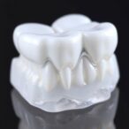 nano-hydroxyapatite-boosts-chewing,-reduces-inflammation